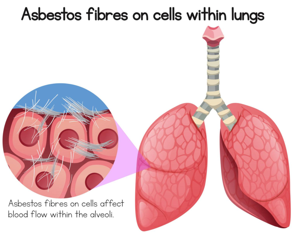 Effects of Asbestos 